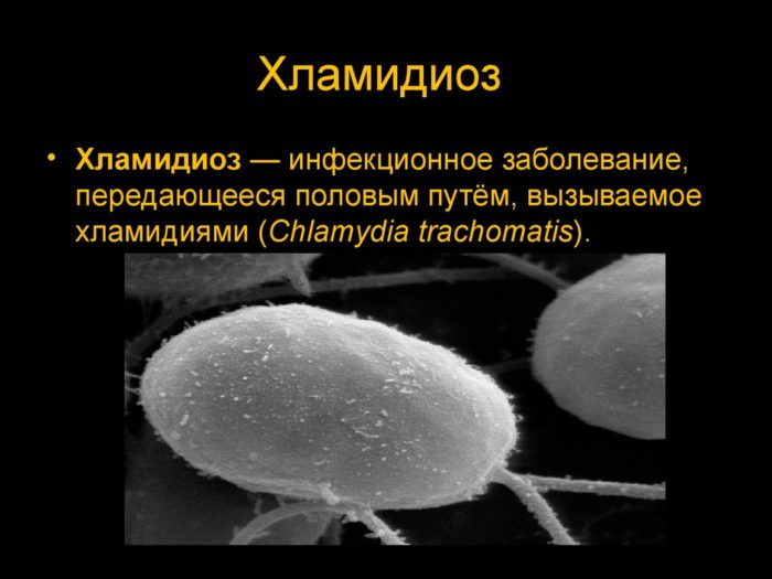 5 признаков хламидиоза у женщин - как сдавать анализы, схема лечения